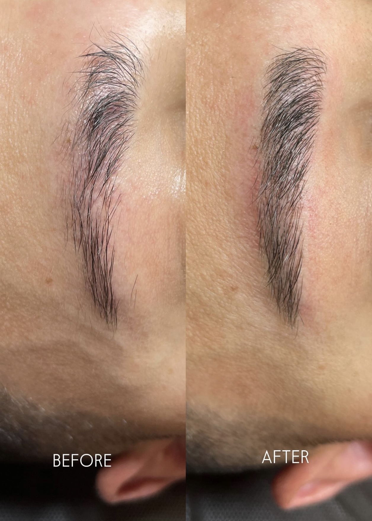 Before After brow shaping