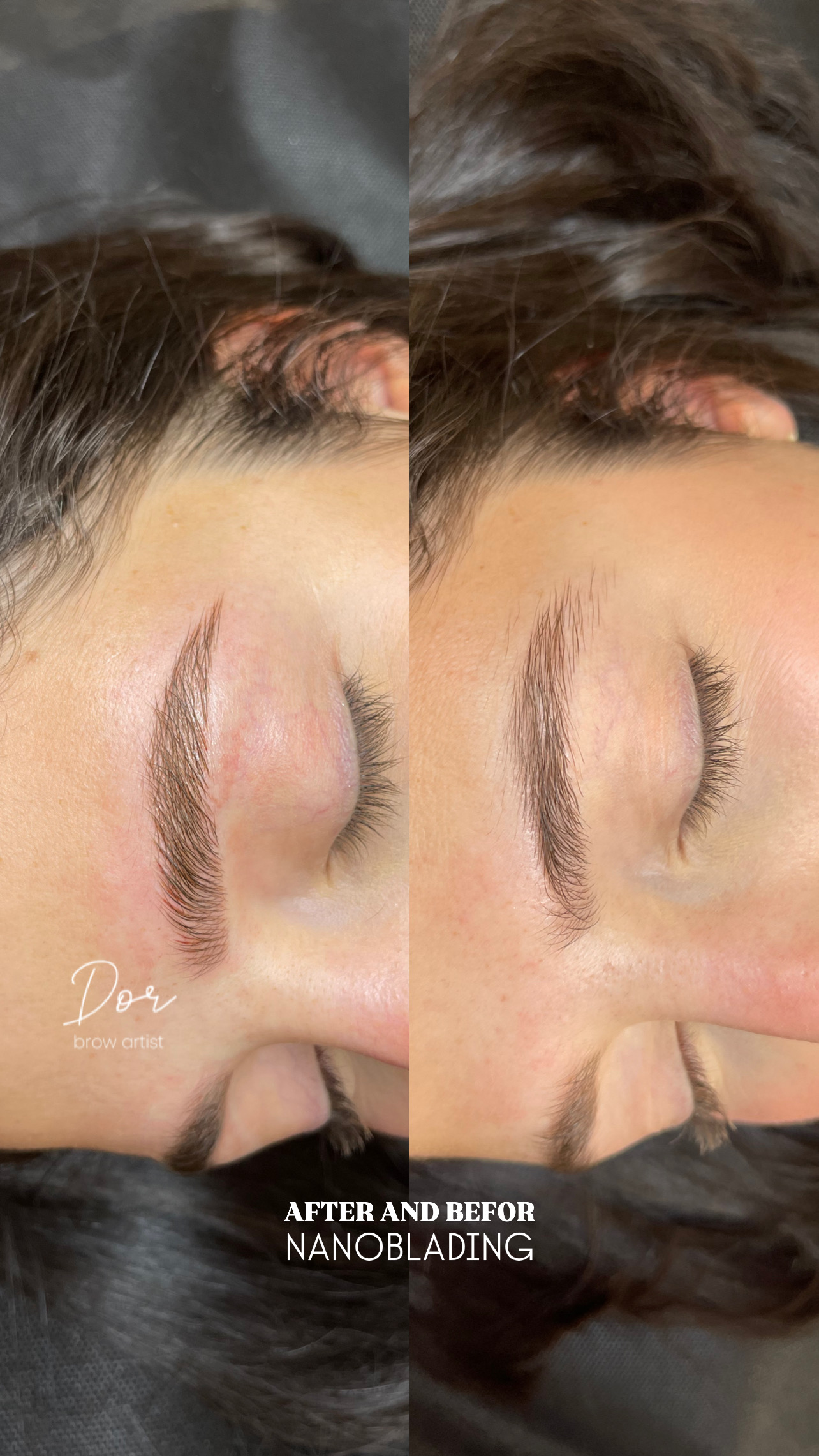 After and Before Nanoblading